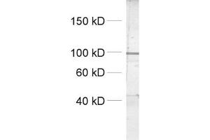 dilution: 1 : 1000, sample: crude synaptosomal fraction of rat brain (P2) (Dynamin 1, 2, 3 (AA 2-17) anticorps)