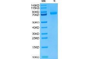 Leucine Rich Repeat Containing 15 (LRRC15) (AA 22-536) (Active) protein (His tag)