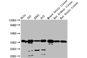 Western blot All lanes: METRNL antibody at 2 μg/mL Lane 1: Mouse small intestine tissue Lane 2: Mouse kidney tissue Lane 3: Rat gonadal tissue Lane 4: Mouse brain tissue Secondary Goat polyclonal to rabbit IgG at 1/10000 dilution Predicted band size: 35, 26 kDa Observed band size: 35 kDa (METRNL anticorps  (AA 46-311))