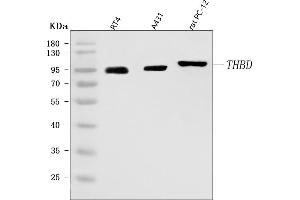 Western blot analysis of Thrombomodulin/THBD using anti-Thrombomodulin/THBD antibody (ABIN7601141).