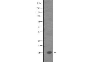 Western blot analysis of IL9 expression in Human fetal liver lysate,The lane on the left is treated with the antigen-specific peptide. (IL-9 anticorps  (Internal Region))