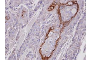 anti-Carnitine O-Octanoyltransferase (CROT) antibody