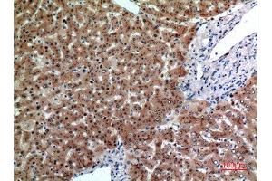 Immunohistochemistry (IHC) analysis of paraffin-embedded Human Liver, antibody was diluted at 1:100. (CEACAM5 anticorps  (Internal Region))