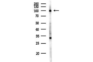 anti-Adaptor-Related Protein Complex 2, alpha 2 Subunit (AP2A2) (Internal Region) antibody