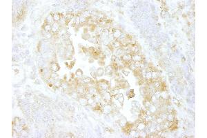 Immunohistochemistry (IHC) image for anti-rho GTPase Activating Protein 1 (ARHGAP1) (AA 1-50) antibody (ABIN7448467) (ARHGAP1 anticorps  (AA 1-50))