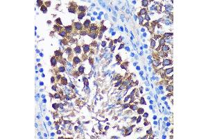 Immunohistochemistry of paraffin-embedded Mouse testis using SENP1 Rabbit pAb (ABIN6132646, ABIN6147534, ABIN6147536 and ABIN6216945) at dilution of 1:100 (40x lens). (SENP1 anticorps  (AA 220-420))