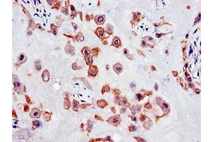 Immunohistochemistry of paraffin-embedded human placenta tissue using ABIN7147677 at dilution of 1:100 (SLC18A1 anticorps  (AA 66-120))