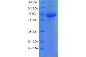 SDS-PAGE (SDS) image for Family with Sequence Similarity 109, Member B (FAM109B) (AA 1-259), (full length) protein (His-SUMO Tag) (ABIN5711451)