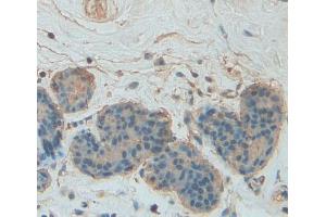 Used in DAB staining on fromalin fixed paraffin- embedded breast tissue (PLIN4 anticorps  (AA 349-656))