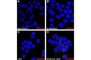 CXCR7 co-localizes with EGFR.