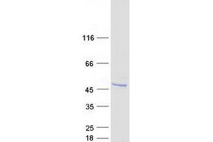 Validation with Western Blot