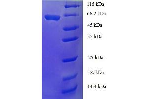 SDS-PAGE (SDS) image for Galactosidase, alpha (GLA) (AA 1-432), (full length) protein (His-SUMO Tag) (ABIN5711197)
