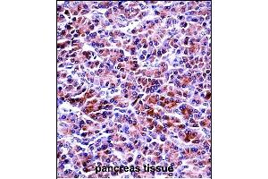PRSS2 Antibody (Center) ((ABIN657641 and ABIN2846637))immunohistochemistry analysis in formalin fixed and paraffin embedded human pancreas tissue followed by peroxidase conjugation of the secondary antibody and DAB staining. (PRSS2 anticorps  (AA 80-108))