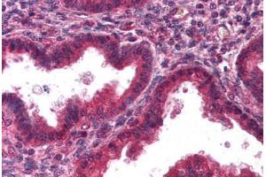 Human Uterus, Endometrium (formalin-fixed, paraffin-embedded) stained with DCN antibody ABIN298189 at 2. (Decorin anticorps)