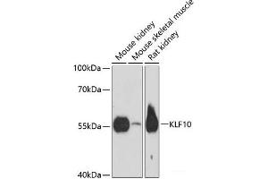 Western blot analysis of extracts of various cell lines using KLF10 Polyclonal Antibody at dilution of 1:3000. (KLF10/TIEG1 anticorps)