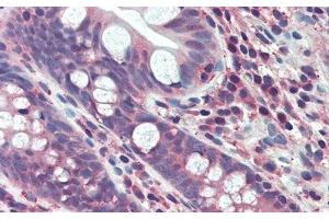 Detection of FGF15 in Human Small intestine Tissue using Polyclonal Antibody to Fibroblast Growth Factor 15 (FGF15)