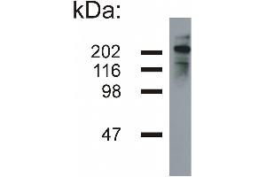Western blotting analysis of neurofilament heavy protein in porcine brain lysate (reducing conditions) by mouse monoclonal NF-05 .