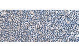 Immunohistochemistry of paraffin-embedded Human tonsil tissue using CNTN4 Polyclonal Antibody at dilution of 1:65(x200)