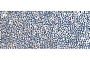 Immunohistochemistry of paraffin-embedded Human tonsil tissue using CNTN4 Polyclonal Antibody at dilution of 1:65(x200) (Contactin 4 anticorps)