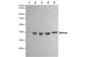anti-MKK3/6 antibody