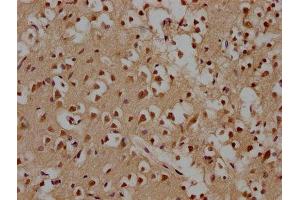 IHC image of ABIN7164625 diluted at 1:100 and staining in paraffin-embedded human brain tissue performed on a Leica BondTM system. (UTP11 anticorps  (AA 1-253))