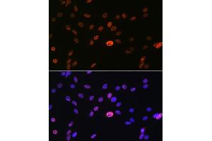 Immunofluorescence analysis of C6 cells using hnRNP  Rabbit mAb (1564) at dilution of 1:100 (40x lens).