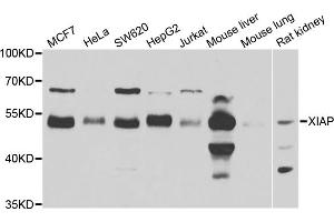 Western blot analysis of extracts of various cell lines, using XIAP antibody. (XIAP anticorps)