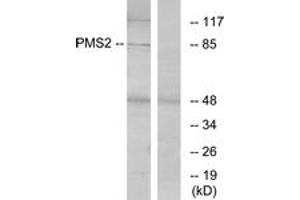 Western Blotting (WB) image for anti-PMS2 Postmeiotic Segregation Increased 2 (S. Cerevisiae) (PMS2) (AA 461-510) antibody (ABIN2890024) (PMS2 anticorps  (AA 461-510))