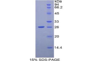 SDS-PAGE analysis of Human GCLC Protein. (GCLC Protéine)