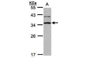 WB Image Sample A: 30μg of Raji whole cell lysate , 12% SDS PAGE antibody diluted at 1:1000