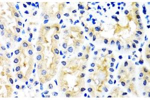 Immunohistochemistry of paraffin-embedded Mouse kidney using SNAP29 Polyclonal Antibody at dilution of 1:100 (40x lens). (SNAP29 anticorps)