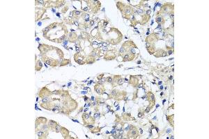 Immunohistochemistry of paraffin-embedded human stomach using BCS1L antibody (ABIN5975615) at dilution of 1/100 (40x lens). (BCS1L anticorps)