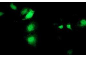Anti-SEC14L2 mouse monoclonal antibody (ABIN2455150) immunofluorescent staining of COS7 cells transiently transfected by pCMV6-ENTRY SEC14L2 (RC215994). (SEC14L2 anticorps)