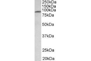 ABIN2563856 (1µg/ml) staining of Human Heart lysate (35µg protein in RIPA buffer). (MFSD6 anticorps  (Internal Region))