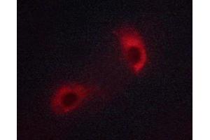 ABIN6267313 staining Jurkat cells by ICC/IF.