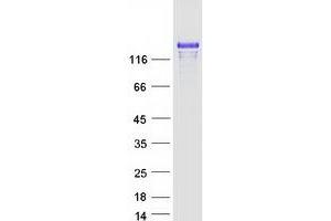 Validation with Western Blot