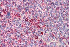 Human Spleen (formalin-fixed, paraffin-embedded) stained with BCL11A antibody ABIN462216 followed by biotinylated goat anti-rabbit IgG secondary antibody ABIN481713, alkaline phosphatase-streptavidin and chromogen.