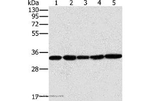 Western blot analysis of Human testis tissue and K562 cell, PC3 cell and human liver cancer tissue, hela cell, using MTCH2 Polyclonal Antibody at dilution of 1:400 (MTCH2 anticorps)