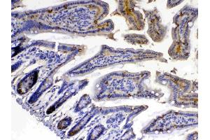 IHC analysis of Xanthine Oxidase using anti-Xanthine Oxidase antibody .