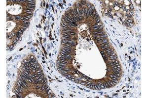 ABIN6266881 at 1/100 staining human Colorectal tissue sections by IHC-P.
