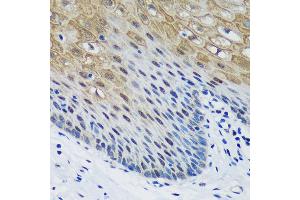 Immunohistochemistry of paraffin-embedded Human esophageal using PSPC1 Rabbit pAb (ABIN6132925, ABIN6146363, ABIN6146364 and ABIN6224928) at dilution of 1:100 (40x lens). (PSPC1 anticorps  (AA 1-70))