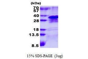 Figure annotation denotes ug of protein loaded and % gel used. (CHMP1A Protéine)