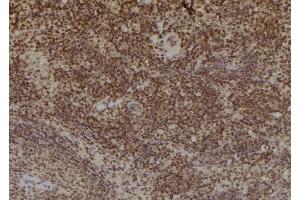 ABIN6269033 at 1/100 staining Mouse spleen tissue by IHC-P. (TYR anticorps)