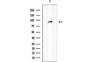 Western blot analysis of lysates from HepG2 cells, using IL4R/CD124 Mouse Monoclonal Antibody at 1/1000 dilution.