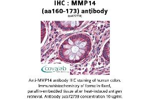 Image no. 3 for anti-Matrix Metallopeptidase 14 (Membrane-inserted) (MMP14) (AA 160-173) antibody (ABIN2852383)