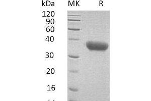 Western Blotting (WB) image for Chemokine (C-X-C Motif) Ligand 16 (CXCL16) protein (His tag) (ABIN7320501)