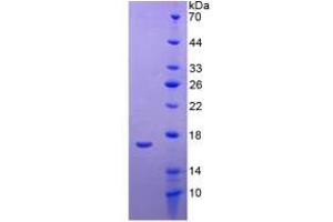 SDS-PAGE of Protein Standard from the Kit (Highly purified E. (APOA1 Kit CLIA)