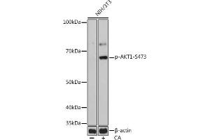 Western blot analysis of extracts of NIH/3T3 cells, using Phospho--S473 mAb (ABIN6135179, ABIN6135970, ABIN6135971 and ABIN7101880) at 1:1000 dilution. (AKT1 anticorps  (pSer473))