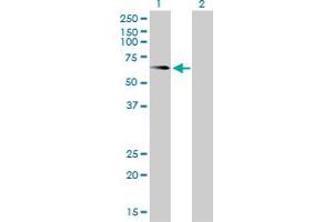 Western Blot analysis of ALPL expression in transfected 293T cell line by ALPL monoclonal antibody (M01), clone 4H1.
