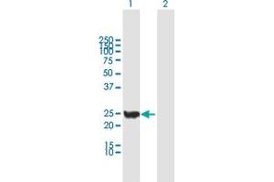 Western Blot analysis of CINP expression in transfected 293T cell line by CINP MaxPab polyclonal antibody. (CINP anticorps  (AA 1-212))